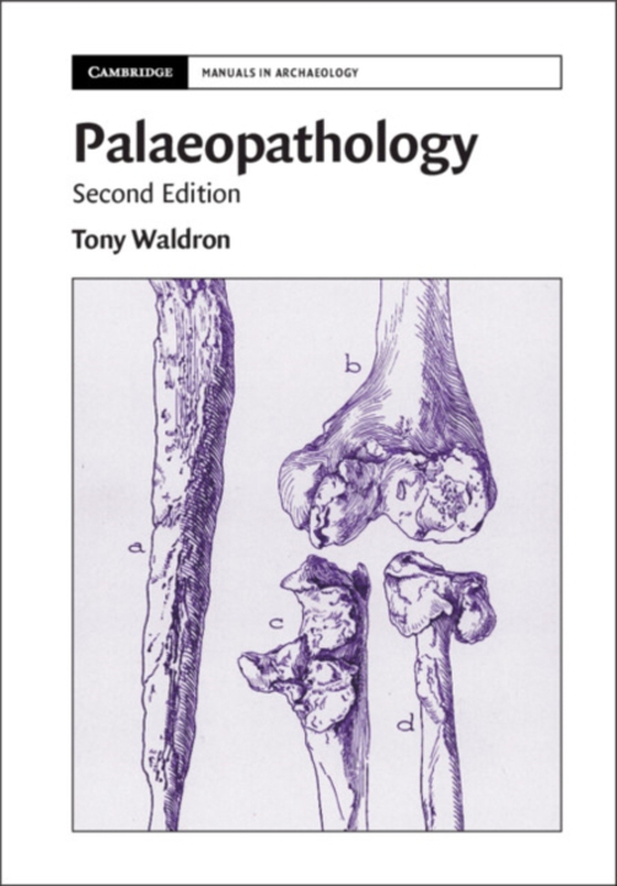 Palaeopathology (e-bog) af Waldron, Tony