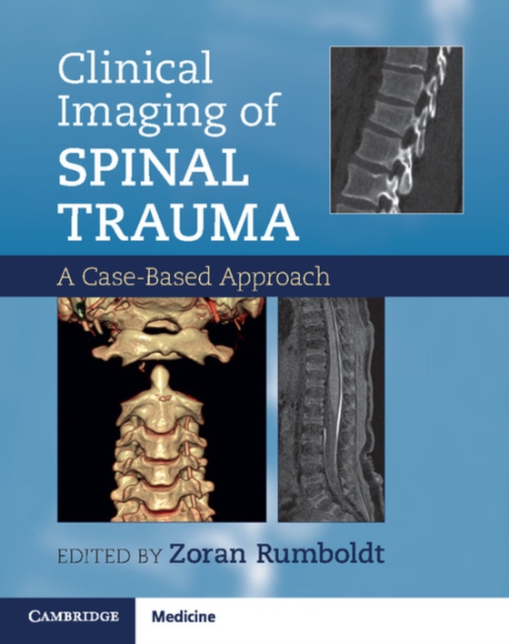 Clinical Imaging of Spinal Trauma (e-bog) af -