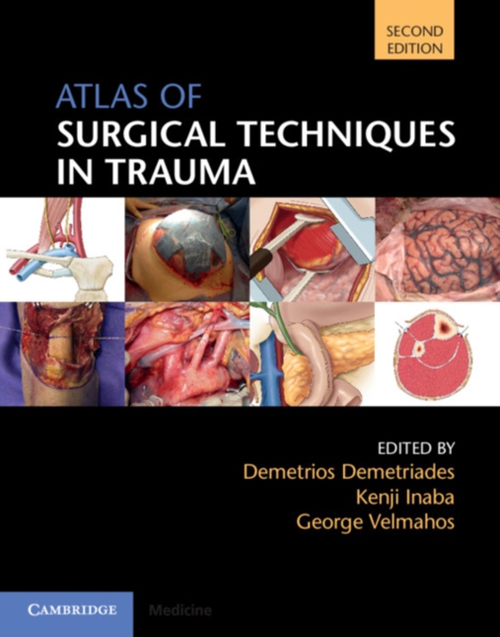 Atlas of Surgical Techniques in Trauma (e-bog) af -