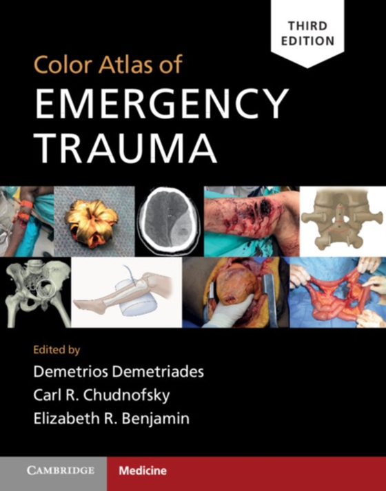 Color Atlas of Emergency Trauma (e-bog) af -