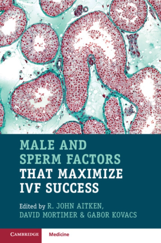 Male and Sperm Factors that Maximize IVF Success (e-bog) af -