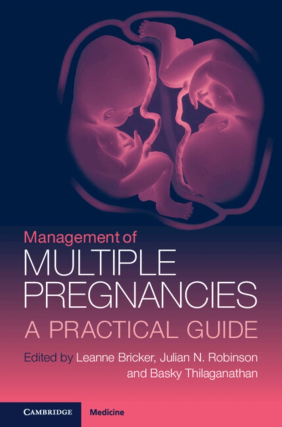 Management of Multiple Pregnancies (e-bog) af -