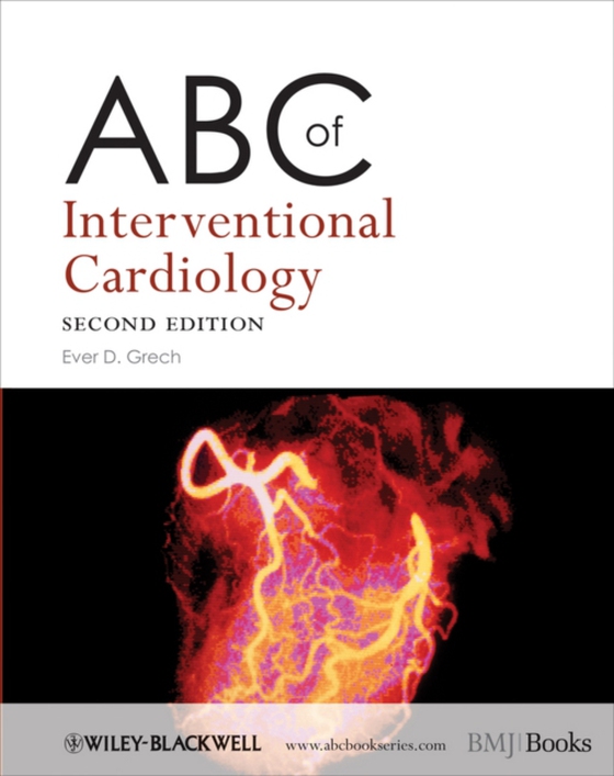 ABC of Interventional Cardiology