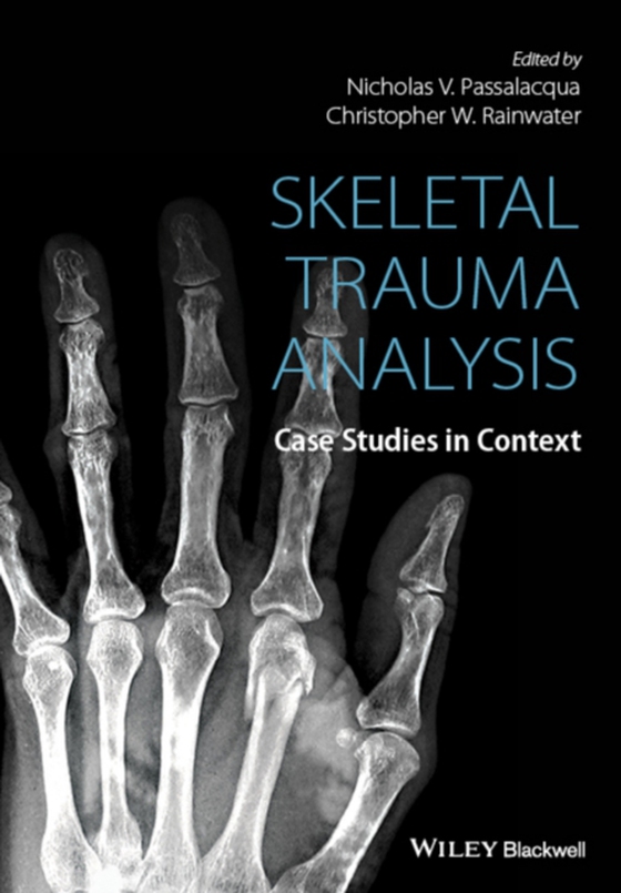 Skeletal Trauma Analysis (e-bog) af -