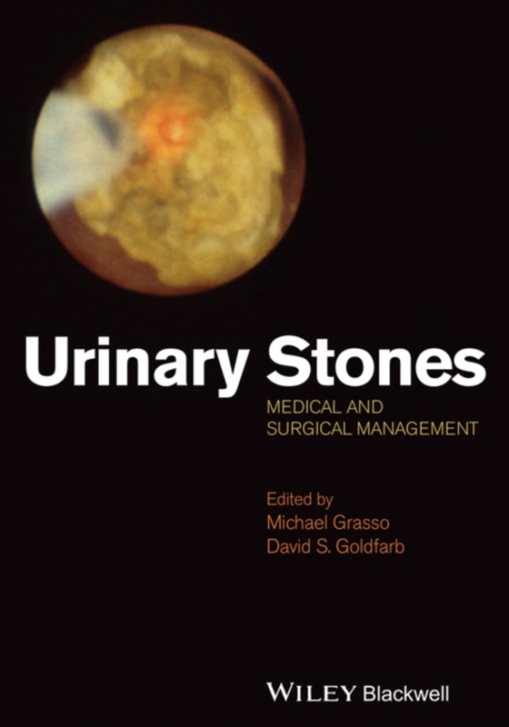 Urinary Stones (e-bog) af -