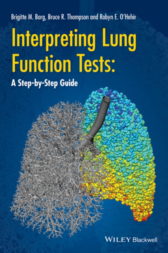 Interpreting Lung Function Tests (e-bog) af O'Hehir, Robyn E.