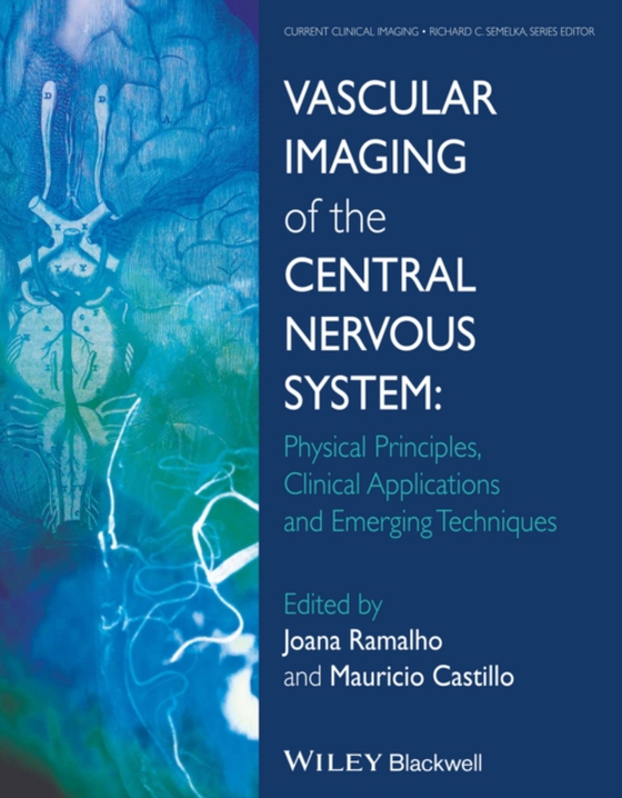 Vascular Imaging of the Central Nervous System (e-bog) af -