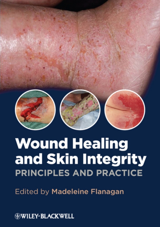 Wound Healing and Skin Integrity (e-bog) af Flanagan, Madeleine