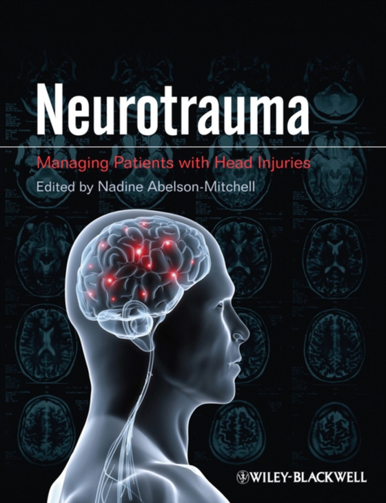 Neurotrauma