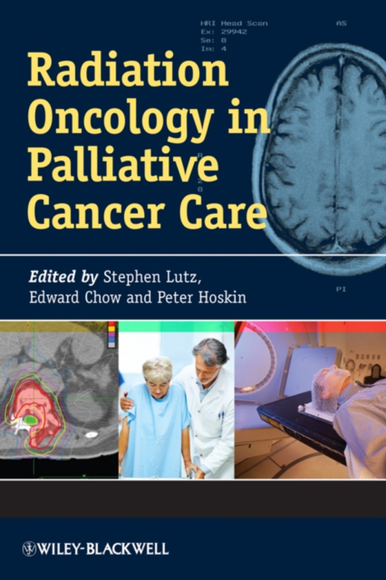 Radiation Oncology in Palliative Cancer Care (e-bog) af -