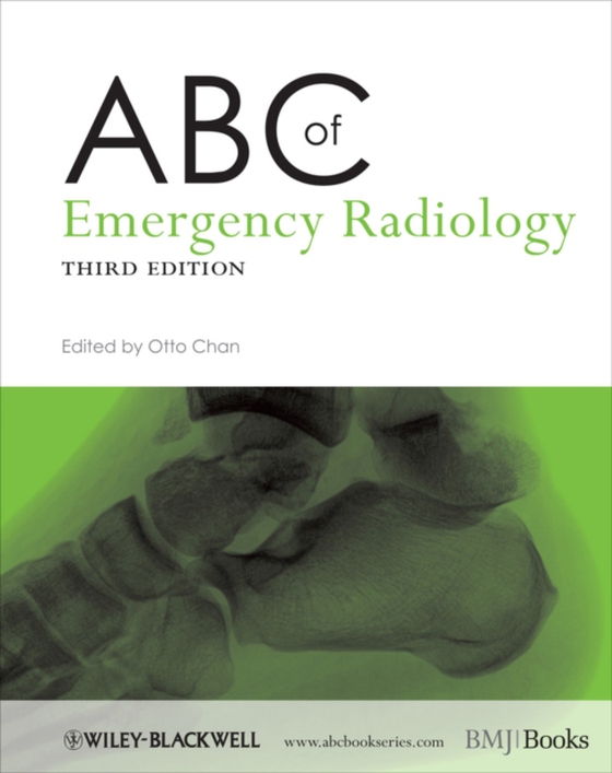 ABC of Emergency Radiology (e-bog) af -