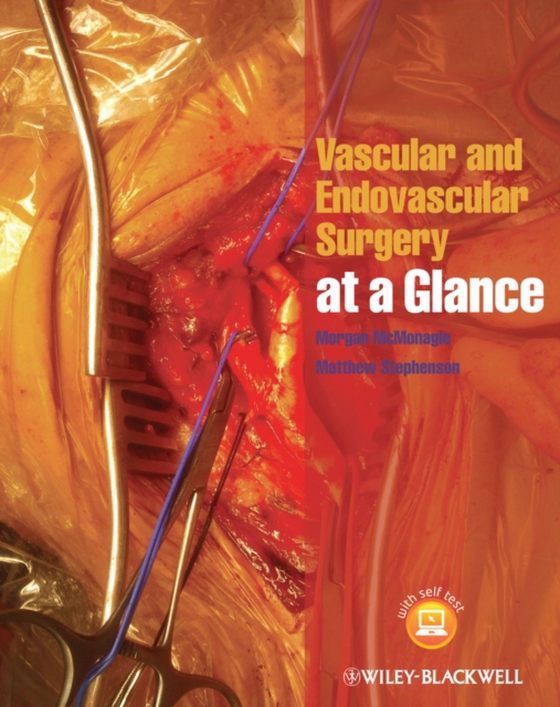 Vascular and Endovascular Surgery at a Glance (e-bog) af Stephenson, Matthew