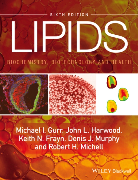 Lipids (e-bog) af Michell, Robert H.