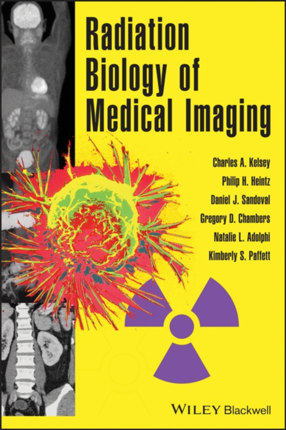 Radiation Biology of Medical Imaging (e-bog) af Paffett, Kimberly S.