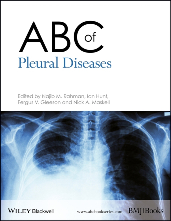 ABC of Pleural Diseases (e-bog) af -