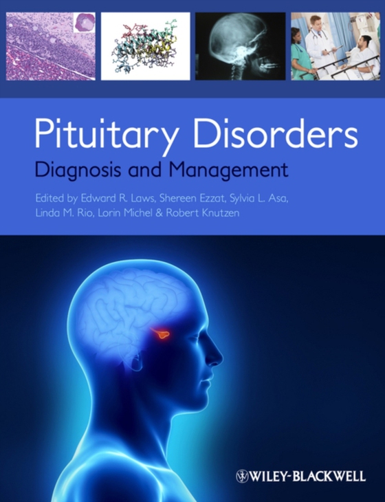 Pituitary Disorders (e-bog) af -