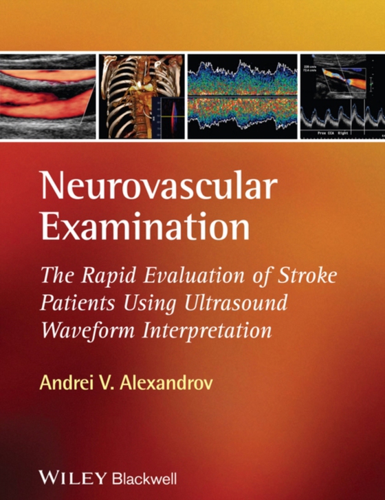 Neurovascular Examination (e-bog) af Alexandrov, Andrei V.