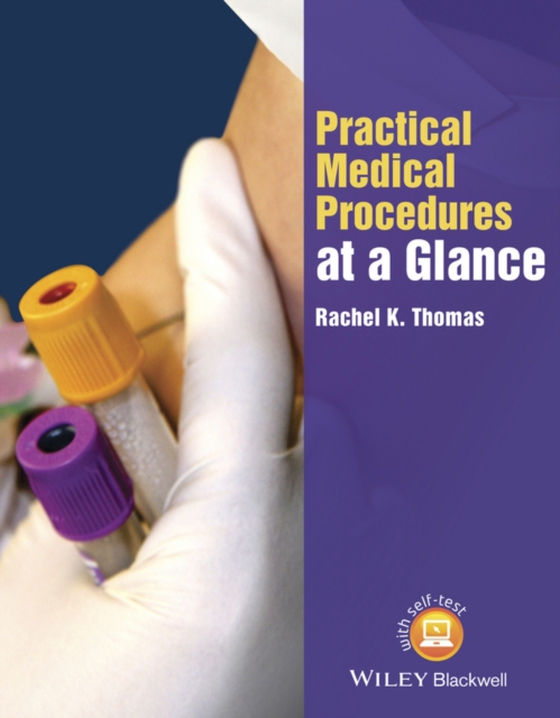 Practical Medical Procedures at a Glance (e-bog) af Thomas, Rachel K.