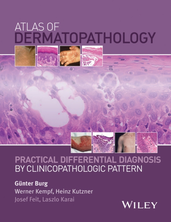 Atlas of Dermatopathology (e-bog) af -