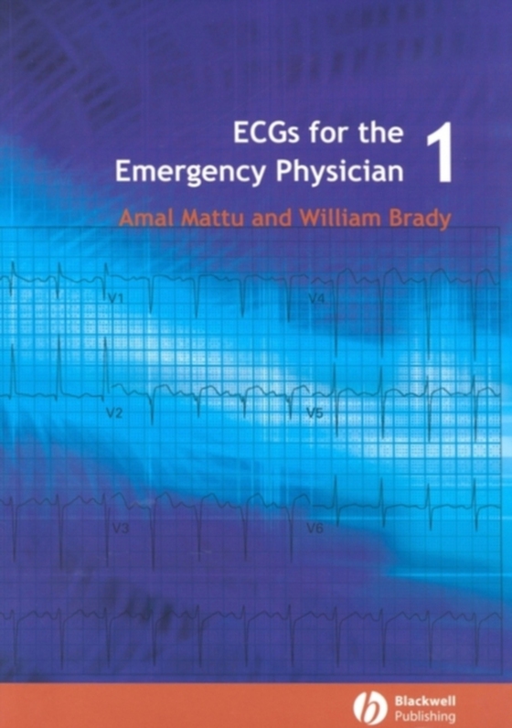 ECGs for the Emergency Physician 1 (e-bog) af Mattu, Amal