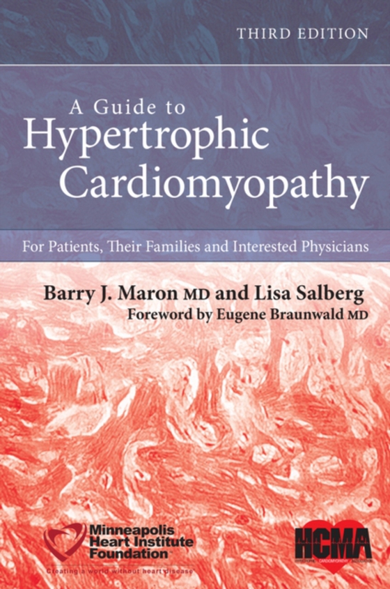 Guide to Hypertrophic Cardiomyopathy