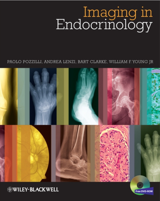 Imaging in Endocrinology (e-bog) af William F. Young, Jr.