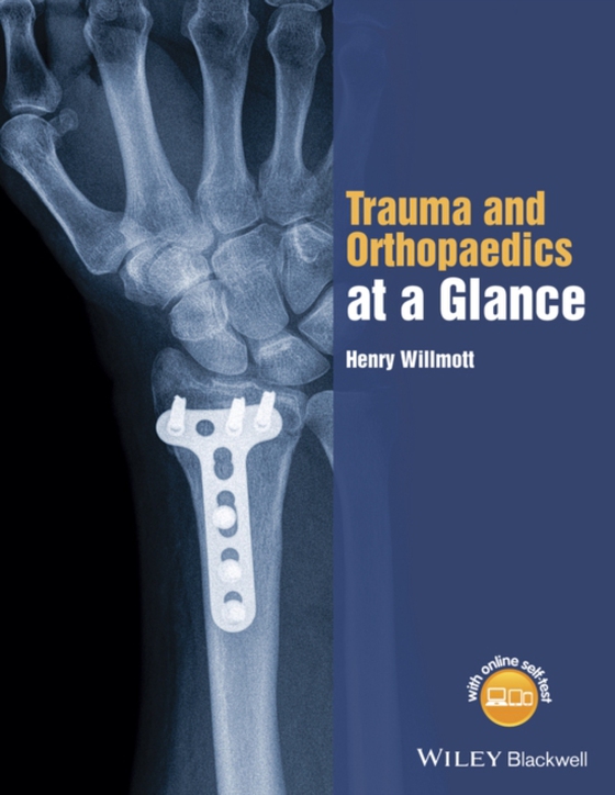 Trauma and Orthopaedics at a Glance (e-bog) af Willmott, Henry