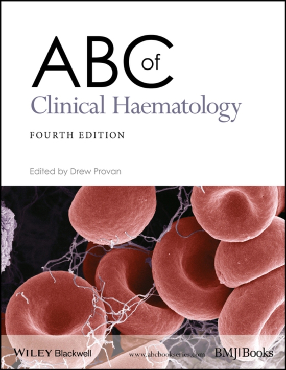 ABC of Clinical Haematology (e-bog) af -