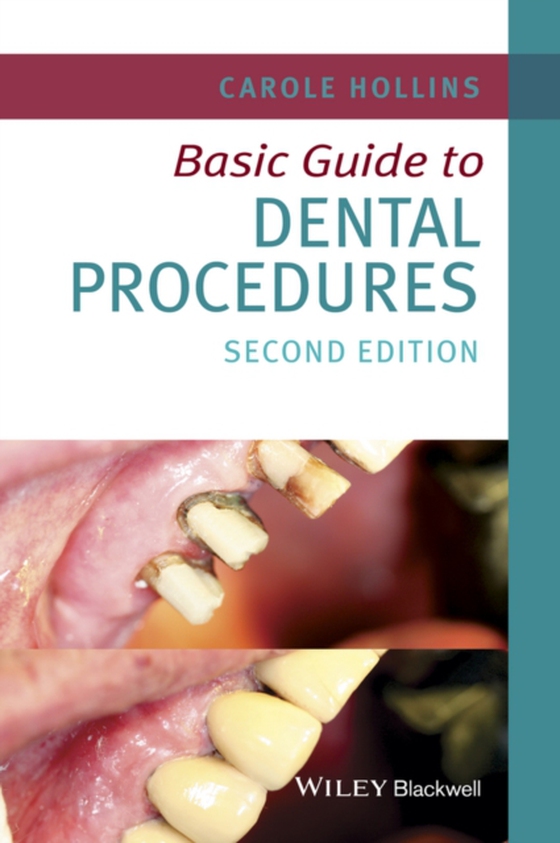 Basic Guide to Dental Procedures (e-bog) af Hollins, Carole