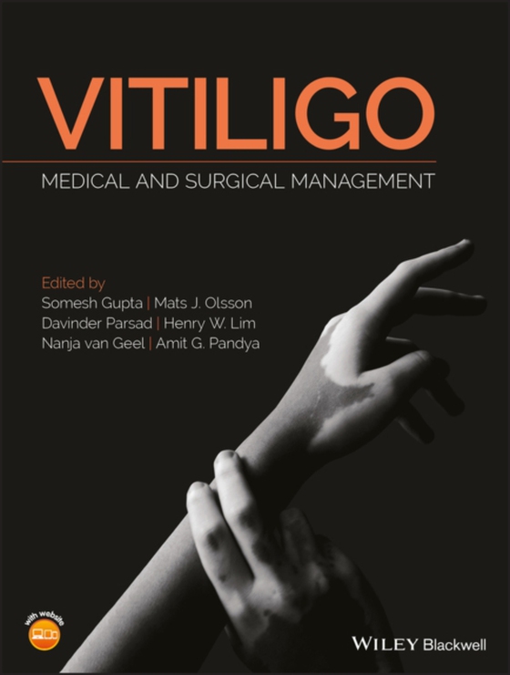 Vitiligo (e-bog) af -