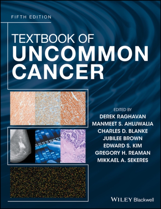Textbook of Uncommon Cancer (e-bog) af -