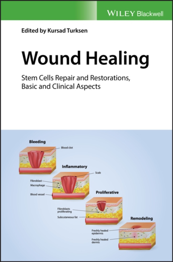 Wound Healing (e-bog) af -