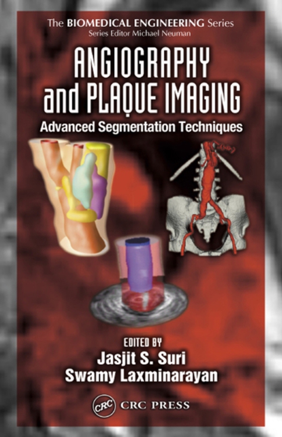 Angiography and Plaque Imaging (e-bog) af -