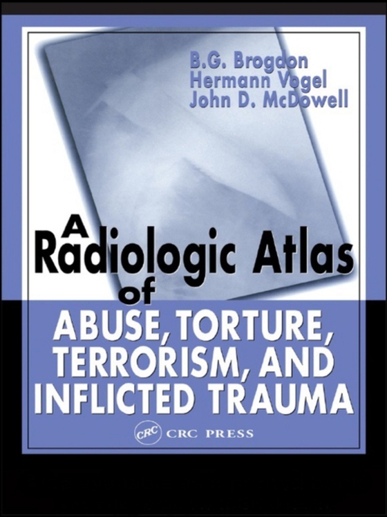 Radiologic Atlas of Abuse, Torture, Terrorism, and Inflicted Trauma (e-bog) af McDowell, John D.