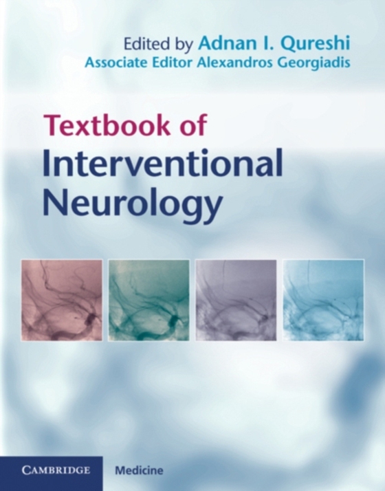 Textbook of Interventional Neurology (e-bog) af -