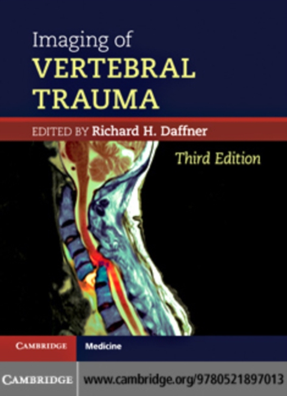 Imaging of Vertebral Trauma (e-bog) af Daffner, Richard H.