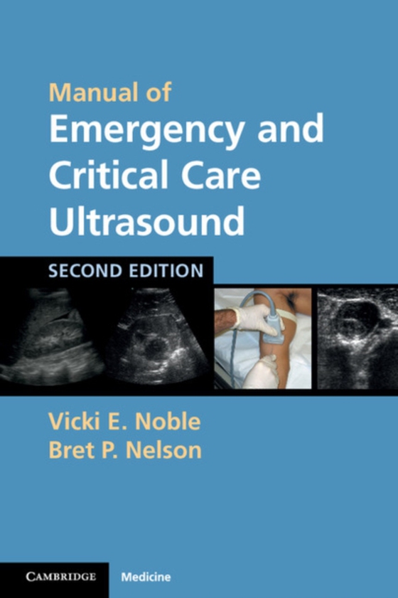 Manual of Emergency and Critical Care Ultrasound (e-bog) af Nelson, Bret P.