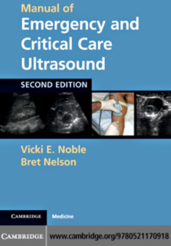 Manual of Emergency and Critical Care Ultrasound (e-bog) af Nelson, Bret P.