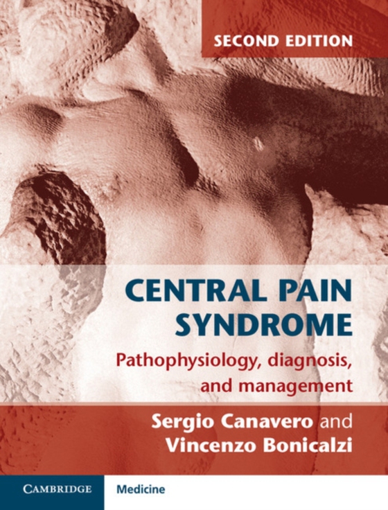 Central Pain Syndrome (e-bog) af Bonicalzi, Vincenzo