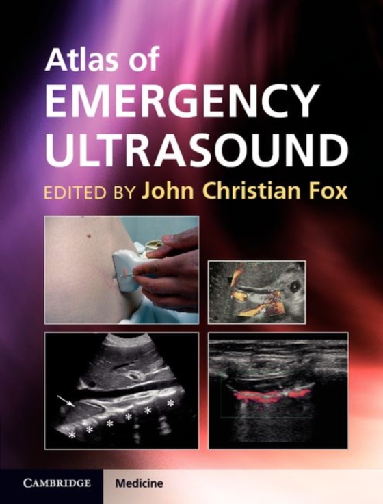 Atlas of Emergency Ultrasound (e-bog) af -