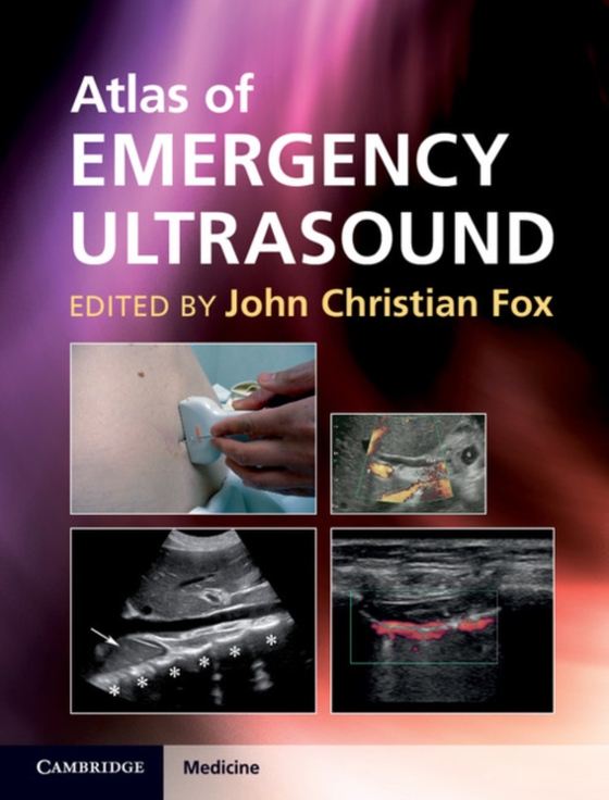 Atlas of Emergency Ultrasound (e-bog) af -