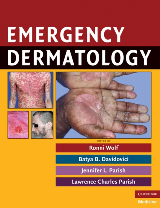 Emergency Dermatology (e-bog) af -