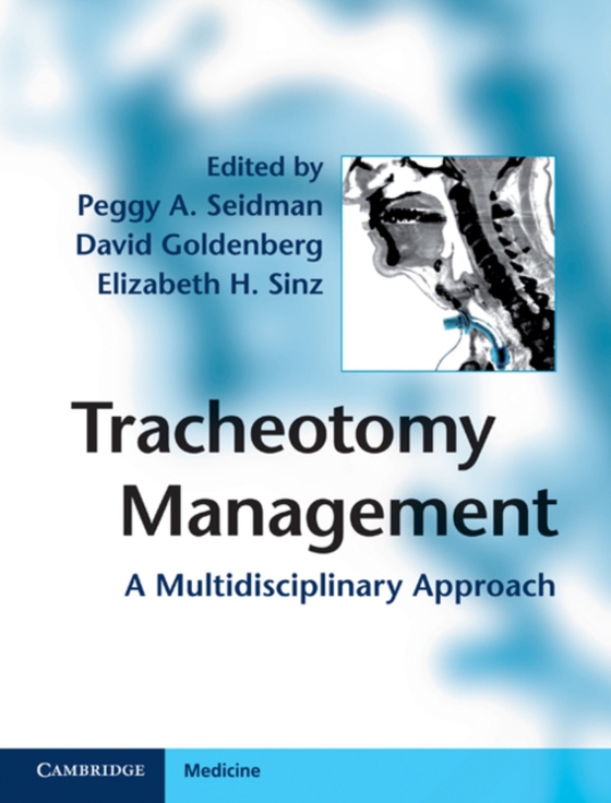 Tracheotomy Management (e-bog) af -