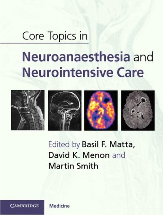 Core Topics in Neuroanaesthesia and Neurointensive Care (e-bog) af -