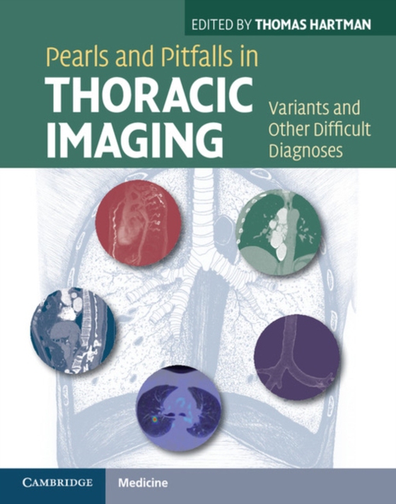 Pearls and Pitfalls in Thoracic Imaging (e-bog) af -