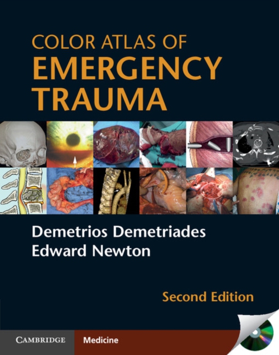 Color Atlas of Emergency Trauma (e-bog) af Newton, Edward