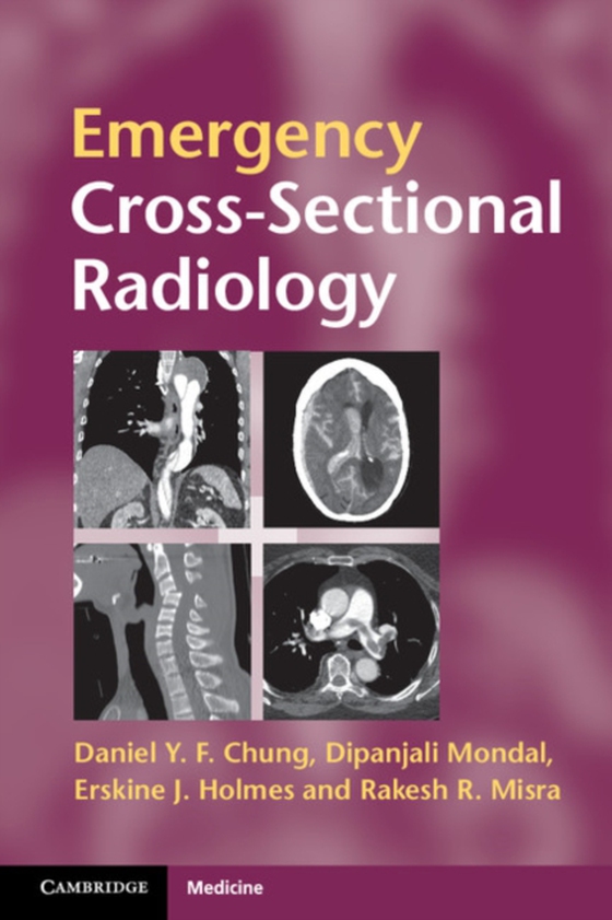 Emergency Cross-sectional Radiology (e-bog) af Misra, Rakesh