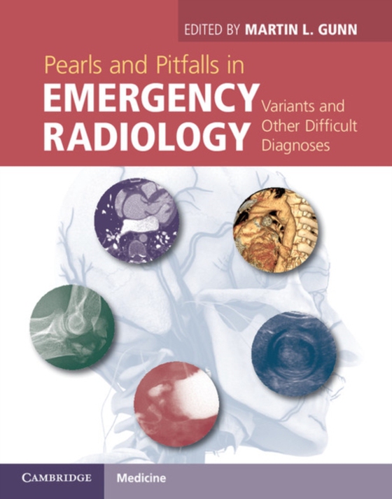 Pearls and Pitfalls in Emergency Radiology (e-bog) af -