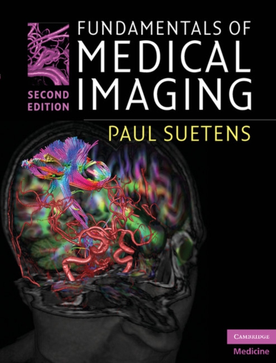 Fundamentals of Medical Imaging