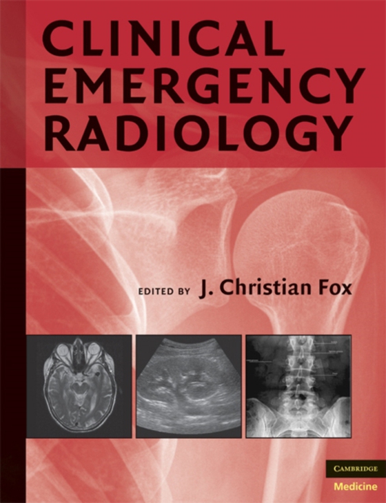 Clinical Emergency Radiology (e-bog) af -